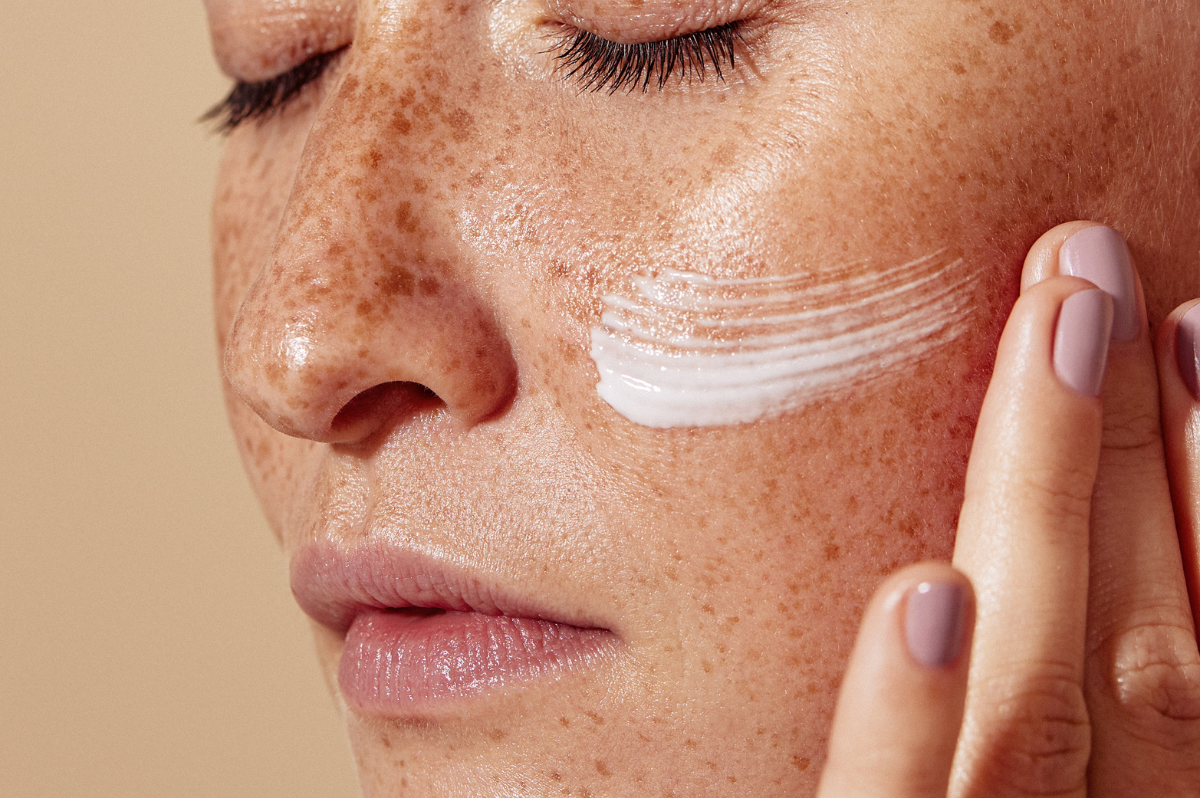 Close-up of a woman applying moisturiser to freckled skin.